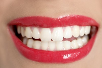 Is There a Difference Between Dental Bleaching and Dental Whitening?